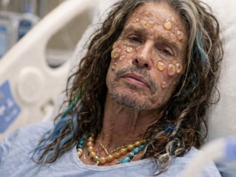 Concern Grows for Steven Tyler as Reports About His Health Spark Worry Among Fans