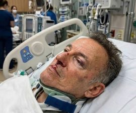 Fans Express Concern After Reports of On-Stage Incident Involving Bruce Springsteen