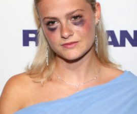 No Longer a Secret? The Rumors About Darci Lynne’s Health Spark Shock, Concern, and a Wave of Support