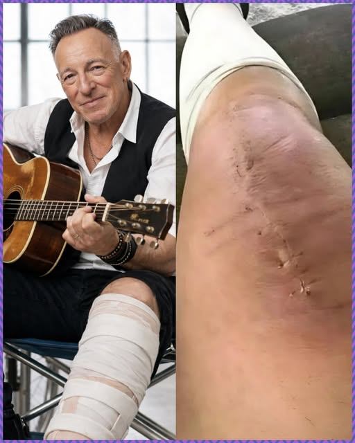 💖🎤 “THE BOSS SPEAKS”: Bruce Springsteen Shares Hopeful Message After Surgery