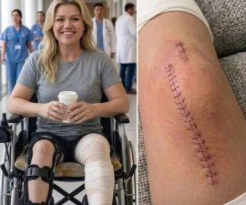 💔 Update No One Expected: Kelly Clarkson Speaks After Surgery — And Her Words Are Resonating Far Beyond Music