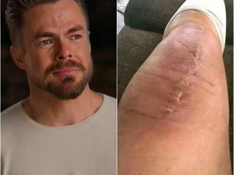 “I’m Fighting — But Not Alone”: Derek Hough Shares Emotional Post-Surgery Message That Moves Fans Worldwide
