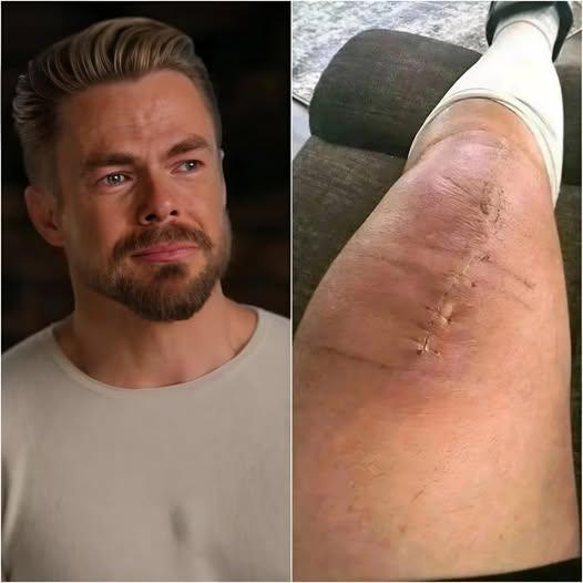 “I’m Fighting — But Not Alone”: Derek Hough Shares Emotional Post-Surgery Message That Moves Fans Worldwide