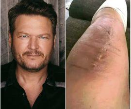 🙏 GOOD NEWS from Blake Shelton: A Heartfelt Message After Surgery Signals Strength, Gratitude, and the Power of Support