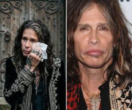 🚨 “NO LONGER A SECRET…” — Steven Tyler Finally Breaks His Silence on Long-Rumored Health Struggles
