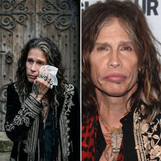 🚨 “NO LONGER A SECRET…” — Steven Tyler Finally Breaks His Silence on Long-Rumored Health Struggles