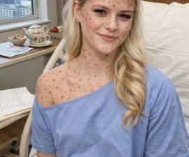 Darci Lynne Breaks Her Silence: “I’m Healing – But I Need My Tribe”