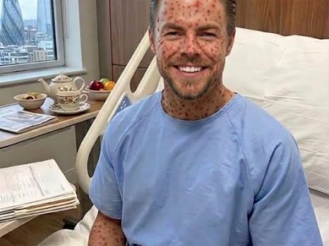 💬 “I’M HEALING — BUT I NEED MY TRIBE”: Derek Hough and the Quiet Reality Behind Stepping Away