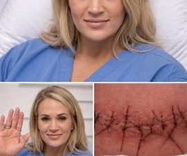 💖 GOOD NEWS: Carrie Underwood Shares Heartfelt Message After Surgery — Fans Breathe a Collective Sigh of Relief