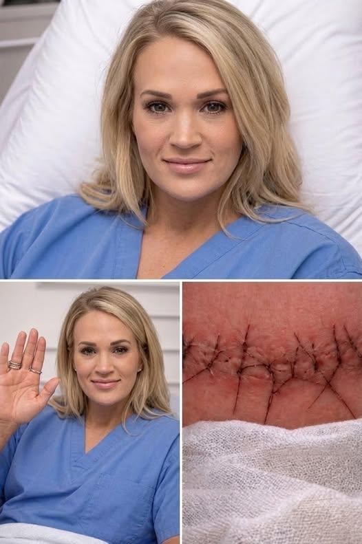💖 GOOD NEWS: Carrie Underwood Shares Heartfelt Message After Surgery — Fans Breathe a Collective Sigh of Relief