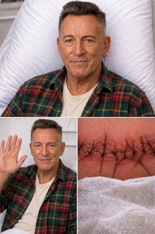 ❤️ GOOD NEWS from Bruce Springsteen: A Heartfelt Message After Surgery Brings Relief to Fans Worldwide