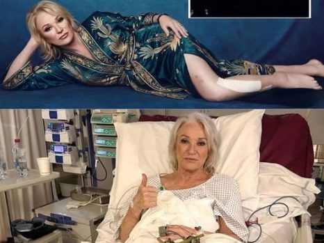 “Please… Don’t Take My Leg… Don’t Take My Life As I Know It…” — Tanya Tucker Opens Up About Fear, Pain, and the Longest Night of Her Life