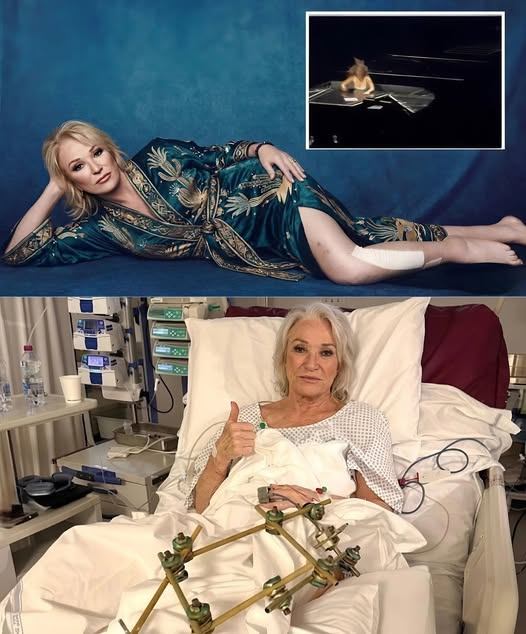 “Please… Don’t Take My Leg… Don’t Take My Life As I Know It…” — Tanya Tucker Opens Up About Fear, Pain, and the Longest Night of Her Life