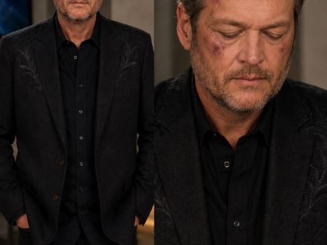 JUST IN… BLAKE SHELTON’S EMOTIONAL CONFESSION STUNS FANS: “I’VE BEEN HIDING THIS FOR WAY TOO LONG”