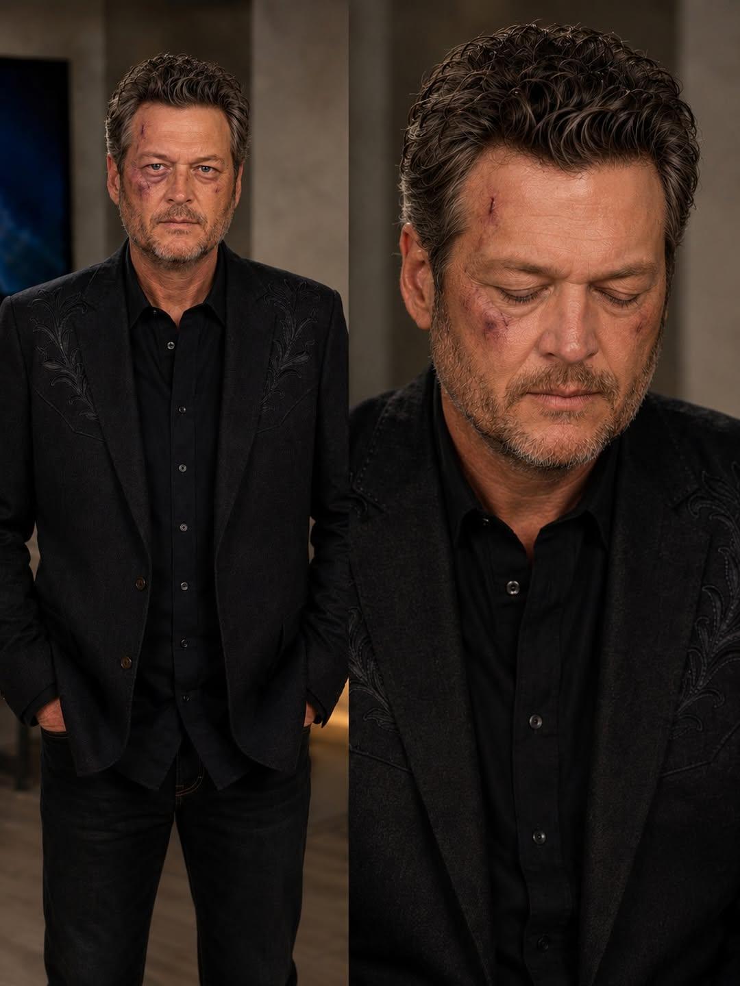 JUST IN… BLAKE SHELTON’S EMOTIONAL CONFESSION STUNS FANS: “I’VE BEEN HIDING THIS FOR WAY TOO LONG”