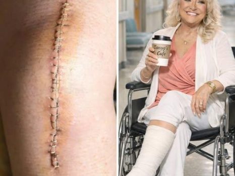 RECOVERY: Tanya Tucker Opens Up About Her Days After Surgery in a Raw and Emotional Update