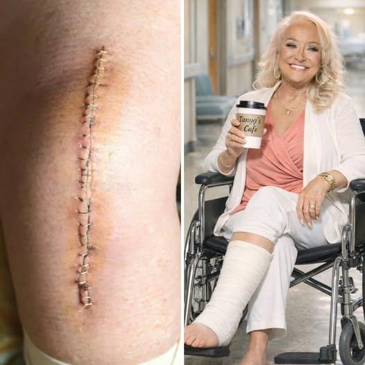 RECOVERY: Tanya Tucker Opens Up About Her Days After Surgery in a Raw and Emotional Update